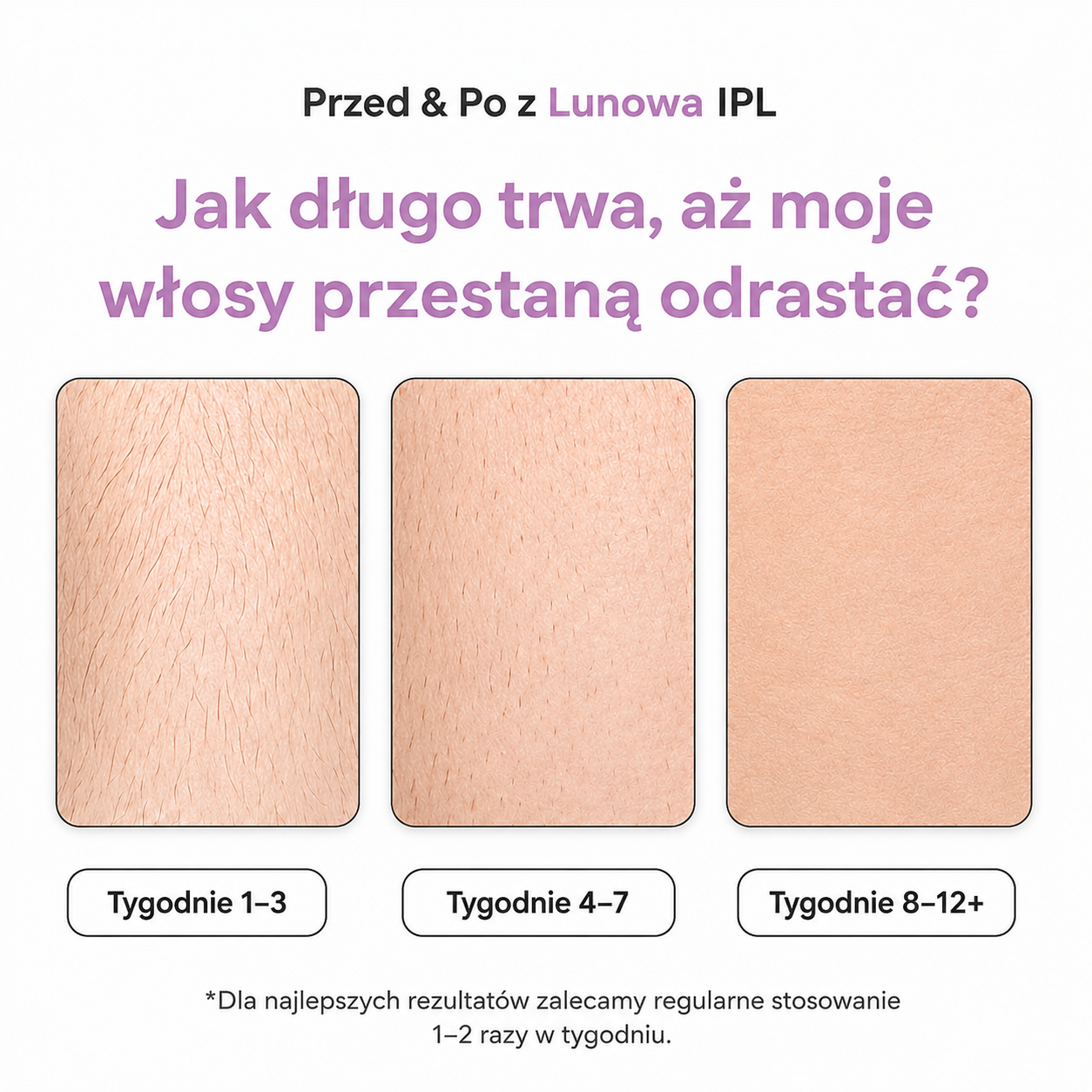 Lunowa IPL I Najlepsza metoda depilacji laserowej do użytku domowego
