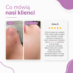Lunowa IPL I Najlepsza metoda depilacji laserowej do użytku domowego