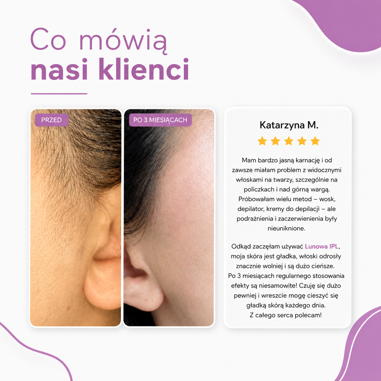 Lunowa IPL I Najlepsza metoda depilacji laserowej do użytku domowego