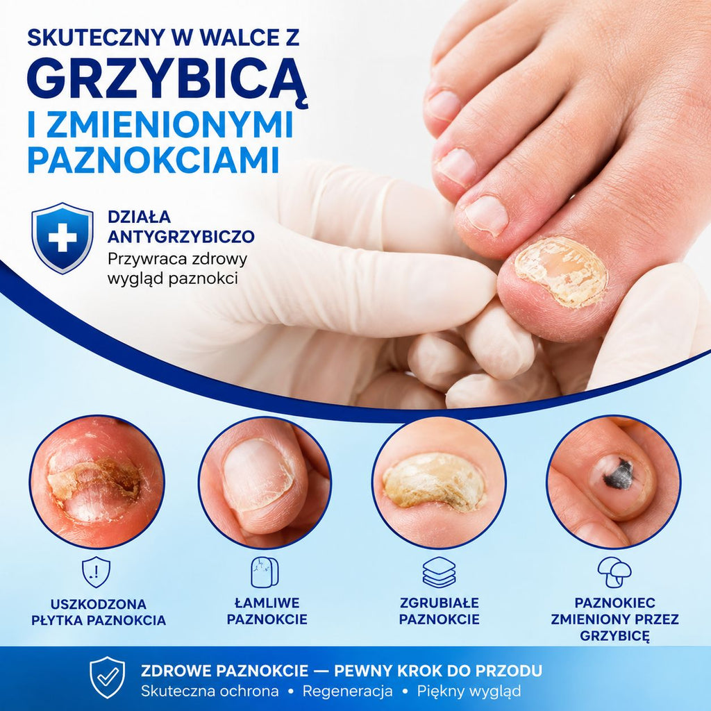 HealthNail – pisak, który zadba o zdrowie Twoich paznokci (1+1, 2+2 gratis)