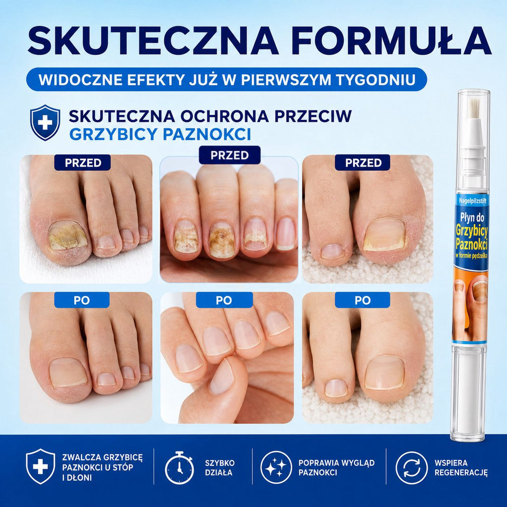 HealthNail – pisak, który zadba o zdrowie Twoich paznokci (1+1, 2+2 gratis)