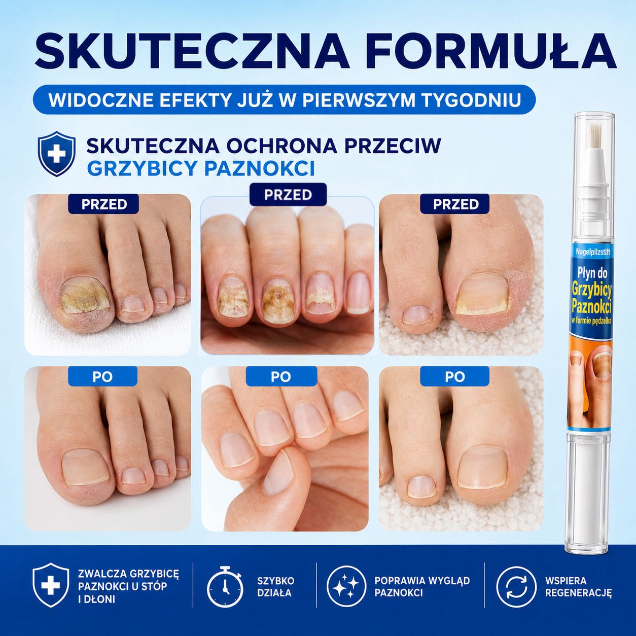 HealthNail – pisak, który zadba o zdrowie Twoich paznokci (1+1, 2+2 gratis)